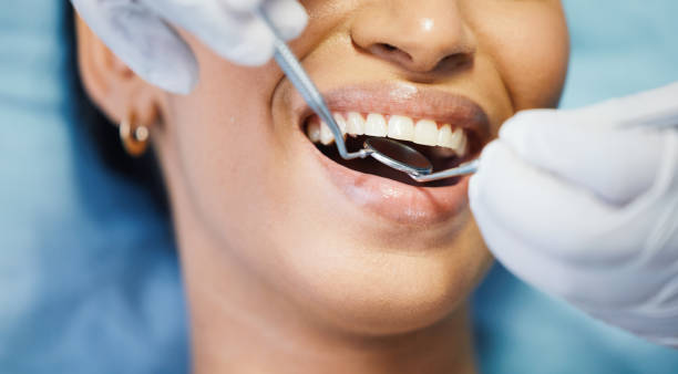 Best Emergency Dental Care for Trauma or Injury in Circle Pines, MN